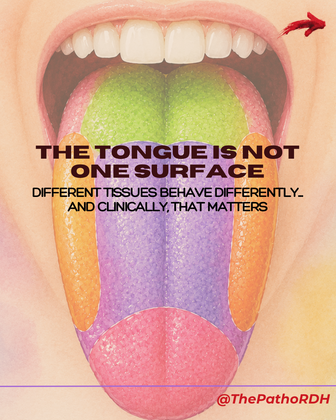 The Tongue Is Not One Surface: 5-mint Clinical Reset